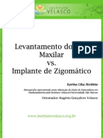 Levantamento Do Seio Maxilar Versus Implante de Zigomático