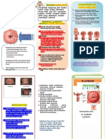 Leaftlet Kanker Serviks