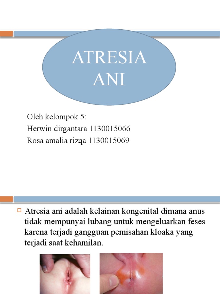 Atresia Ani | PDF | Sains & Matematika