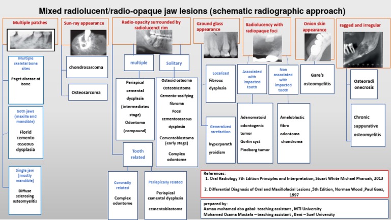 Mixed Radiolucent-Radiopaque Jaw Lesions | PDF | Diseases And Disorders ...