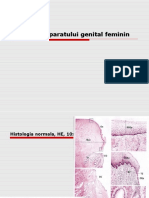 Curs 6 PATOLOGIA APARATULUI  GENITAL  FEMININ