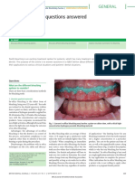 Tooth Bleaching Questions Answered