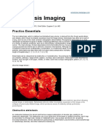 Atelectasis Imaging Findings