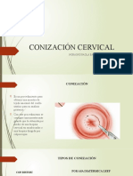 CONIZACIÓN CERVICAL Nora