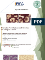 Alterações Eritrocitaria PDF