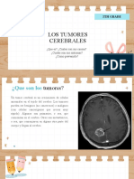 Tumor Cerebral