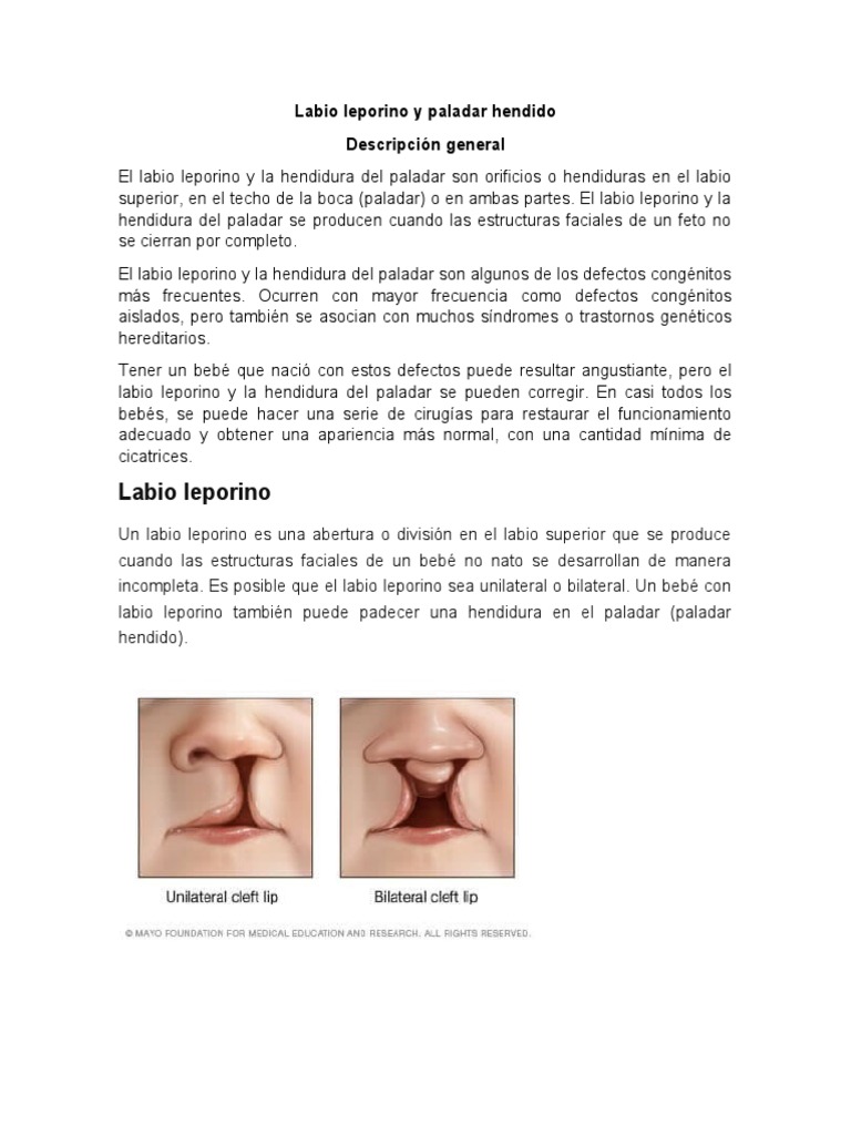 Labio Leporino y Paladar Hendido: Guía Completa | PDF | Cirugía | El ...