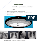 Radiografia de Torax