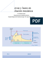 Curvas y lazos en ventilación mecánica