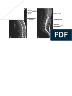 Radiografía Medula Espinal