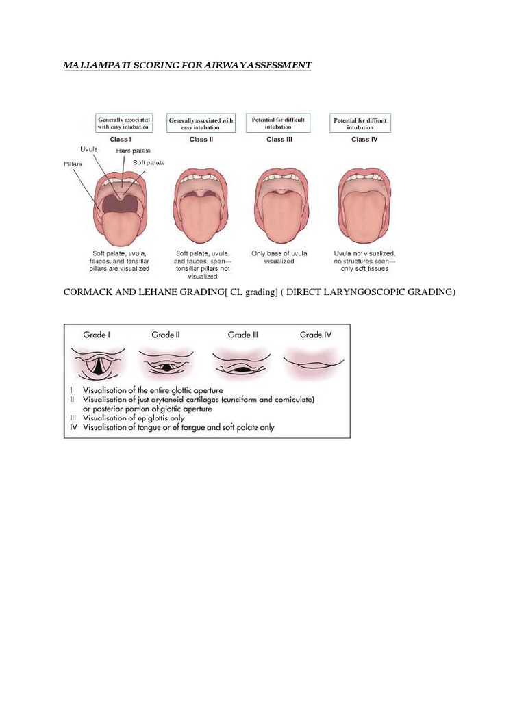 Mallampati and Cormack-Lehane Grading | PDF | Respiratory System ...