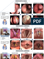 Endoscopias, audiometrías y procedimientos nasales