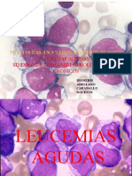 Diapositivas Leucemia Taller Ecaes (1)