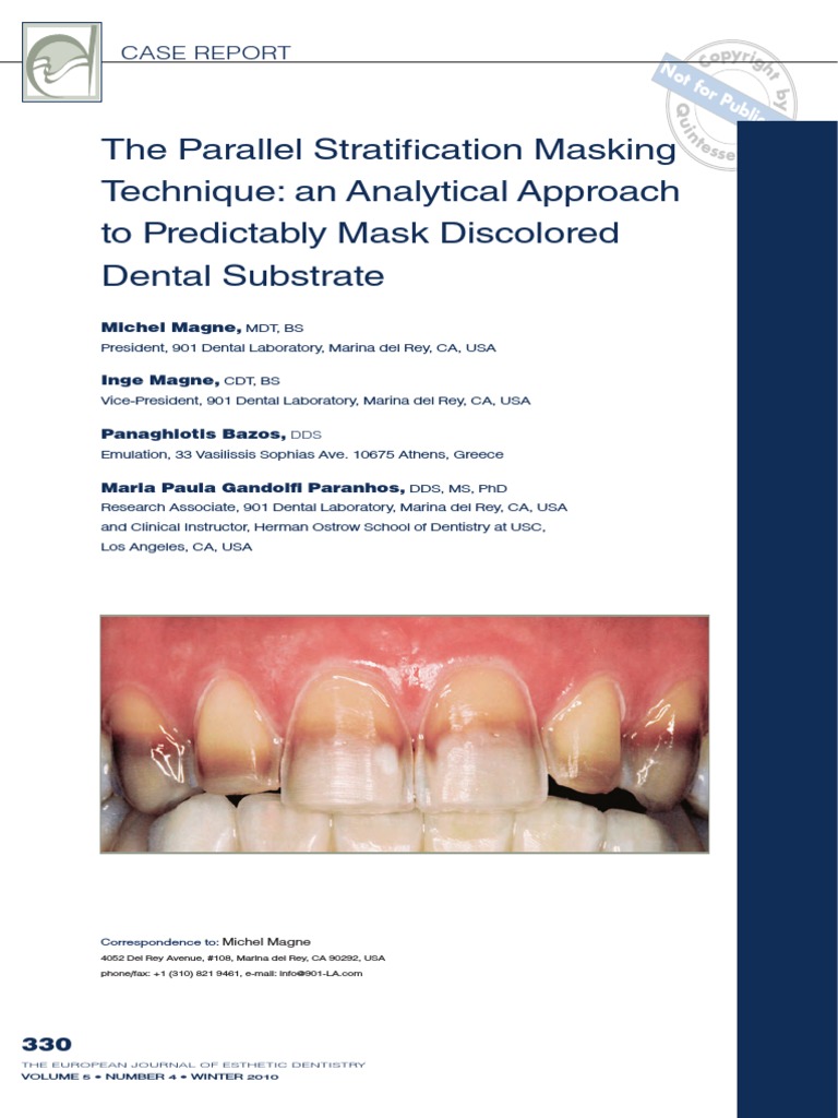 The Parallel Strati cation Masking Technique_ an Analytical Approach to