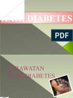 Perawatan Kaki Diabetes