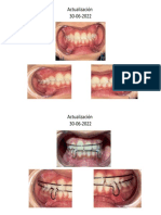 Actualizacion Control de Ortopedia Dentofacial