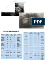 ANÁLISIS CEFALOMÉTRICO Y PANORÁMICO PARA DIAGNÓSTICO ORTODÓNTICO