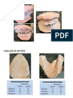 Analisis de Moyers Ortopedia Dentofacial