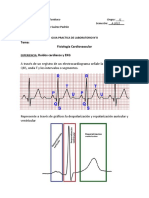 Informe Electrocardiograma