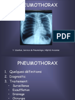 PNEUMOTHORAX