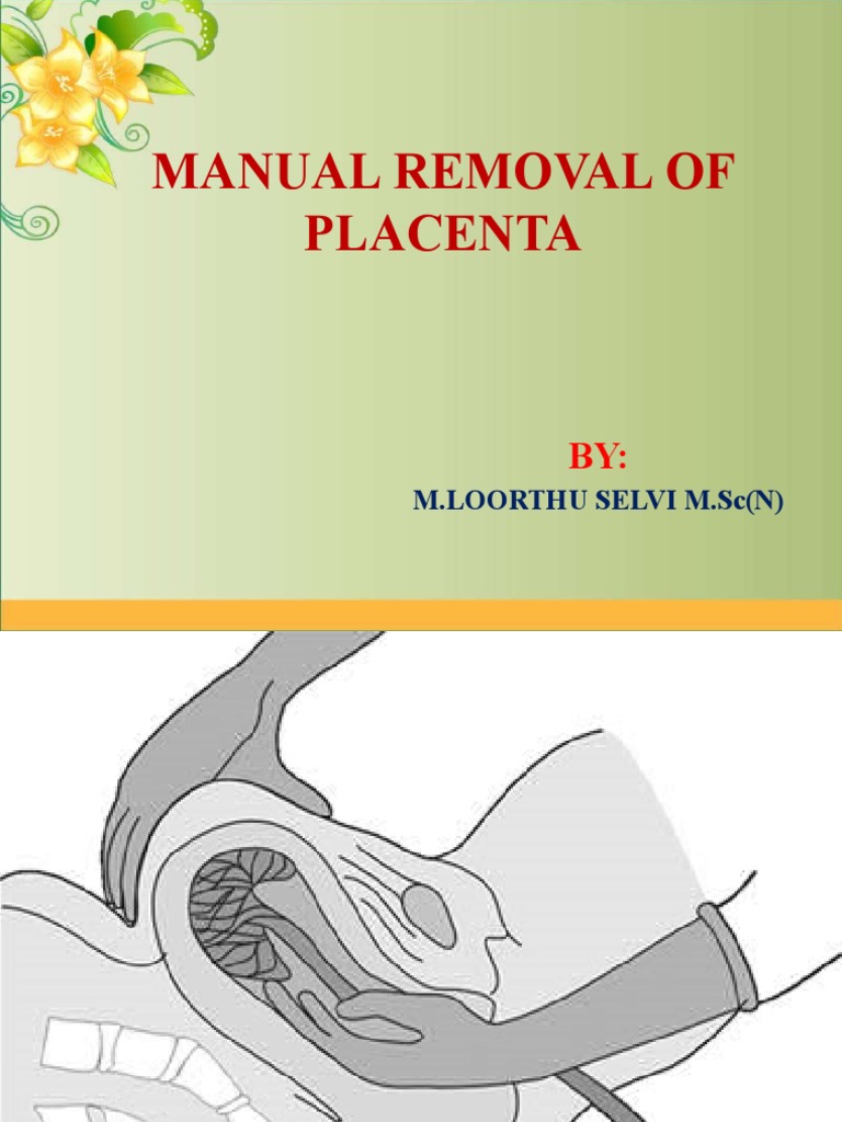 A Comprehensive Guide to Manual Removal of the Placenta PDF Uterus