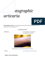 Dermatographic Urticaria - Wikipedia