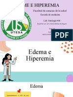 Edema e hiperemia: tipos, etiología y correlaciones clínicas