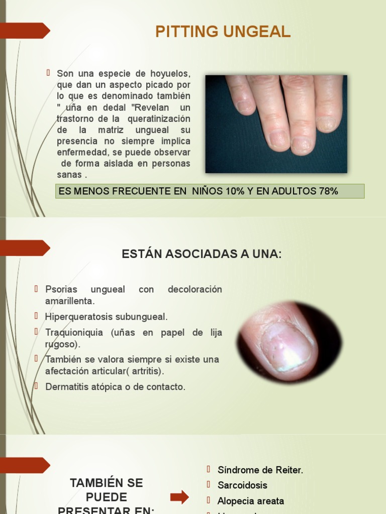 Los Pits | PDF