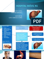 Cirrosis HH