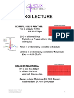 EKG Nclex High Yield