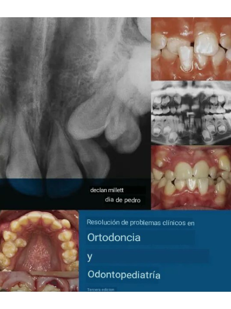 Guía completa de los arcos de ortodoncia