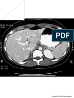 cross sectional anatomy of abd.