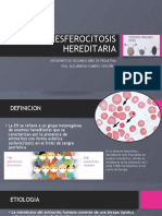 Esferocitosis Hereditaria