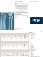 AO/OTA Fracture and Dislocation Classification: Introduction To The Classification of Long-Bone Fractures