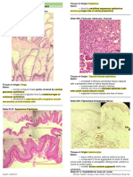 Neoplasia Benign Malignant Tumors