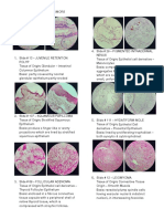 Neoplasia Benign Tumors Laboratory