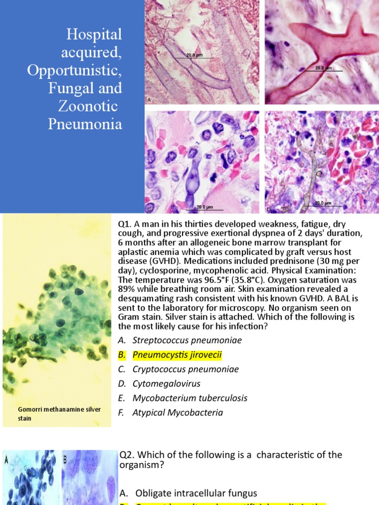 GRAT Fungal, HAI Zoonotic Infections PDF Pneumonia Infection