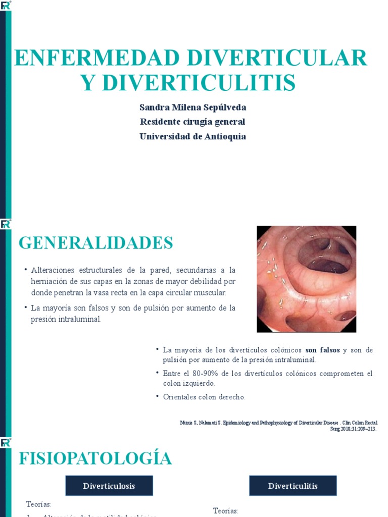 Enfermedad Diverticular y Diverticulitis | PDF | Cáncer colonrectal ...