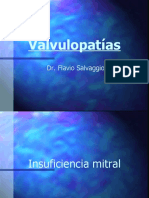 Insuficiencia Mitral