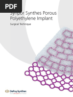 Synpor Synthes Porous Polyethylene Implant: Surgical Technique