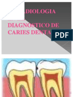 La Radiologia en El Diagnostico de Caries Dental