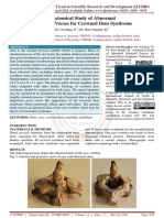 Anatomical Study of Abnormal Odontoid Process For Crowned Dens Syndrome