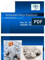 Gelisimsel Kalca Displazisi