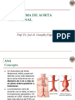 Aneurisma Aorta Abdominal