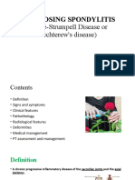 Ankylosing Spondylitis (Marie-Strumpell Disease or