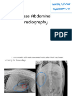 Case x-ray ช่องท้อง