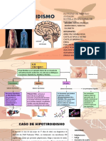 HIPOTIROIDISMO