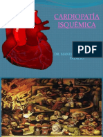Cardiopatía Isquémica