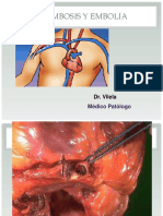 T6. TROMBOSIS Y EMBOLIA (Dr. Vilela)