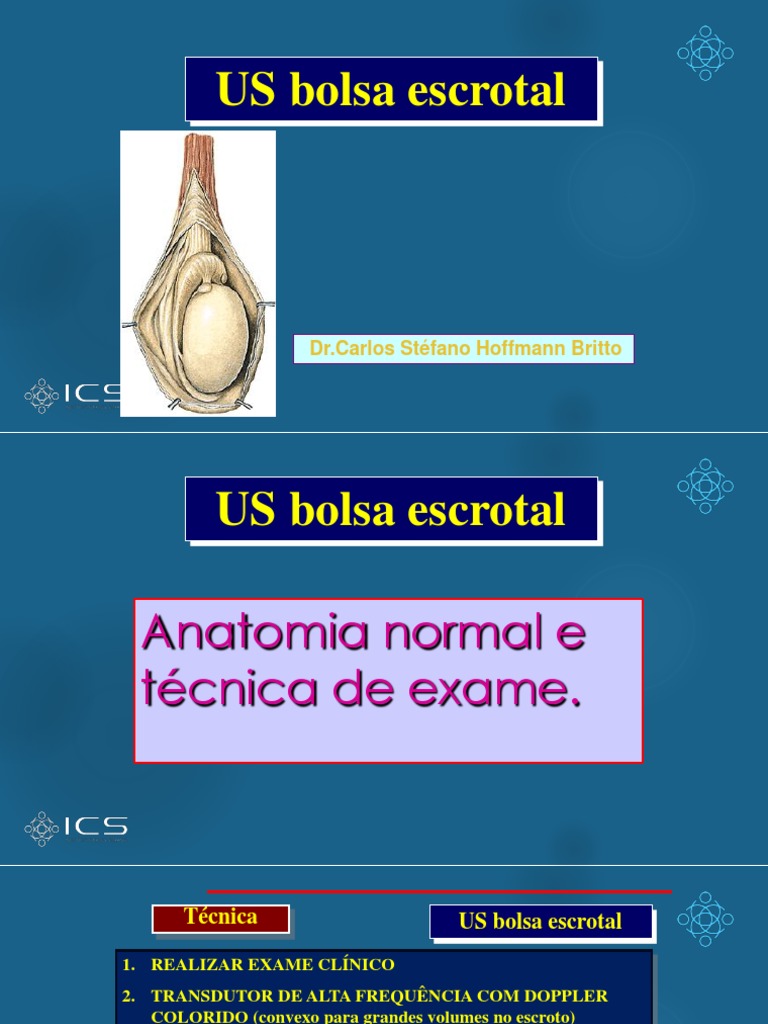 Ultrassom da Bolsa Escrotal: Técnica e Anatomia | PDF | Testículo ...